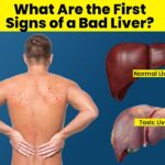 Common Signs Your Liver Might Be In Trouble