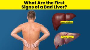 Common Signs Your Liver Might Be In Trouble