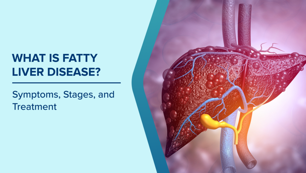 Fatty Liver Disease Causes, Symptoms, And Treatment