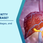 Fatty Liver Disease Causes, Symptoms, And Treatment