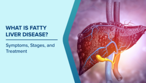 Fatty Liver Disease Causes, Symptoms, And Treatment
