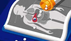 Can Medicines Damage Your Liver Common Drugs to Watch