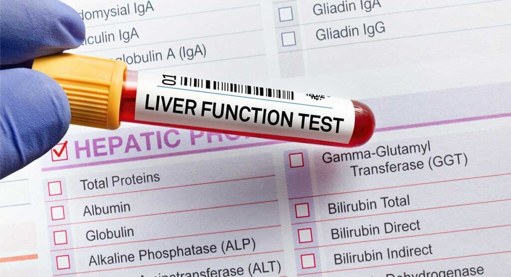 Liver Function Test (LFT) What Do the Results Mean