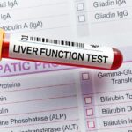Liver Function Test (LFT) What Do the Results Mean