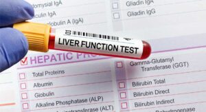 Liver Function Test (LFT) What Do the Results Mean