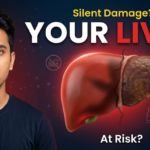 How Lifestyle Is Damaging Your Liver Without You Knowing